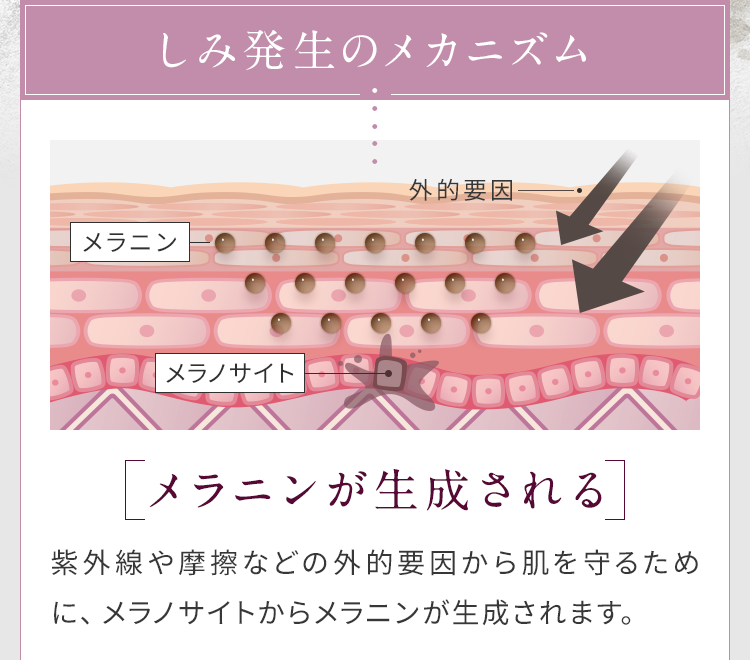 しみ発生のメカニズム