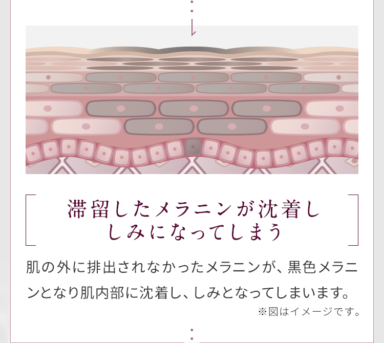 滞留したメラニンが沈着し、しみになってしまう